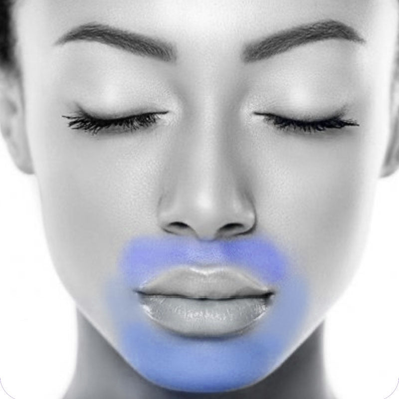 Bigote Laser Labio Superior Manchas Laser Facial Manchas En El