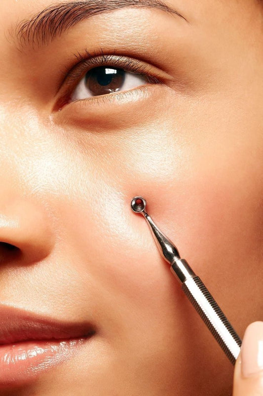 Extracción Facial