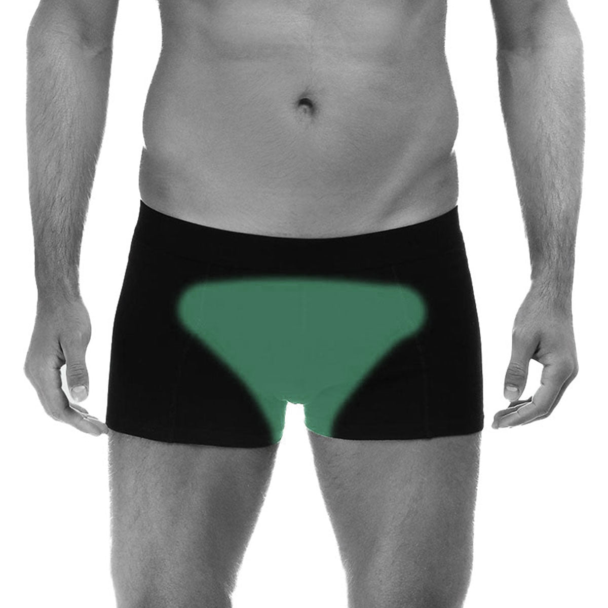 Depilación Láser Brazilian (Caballeros)