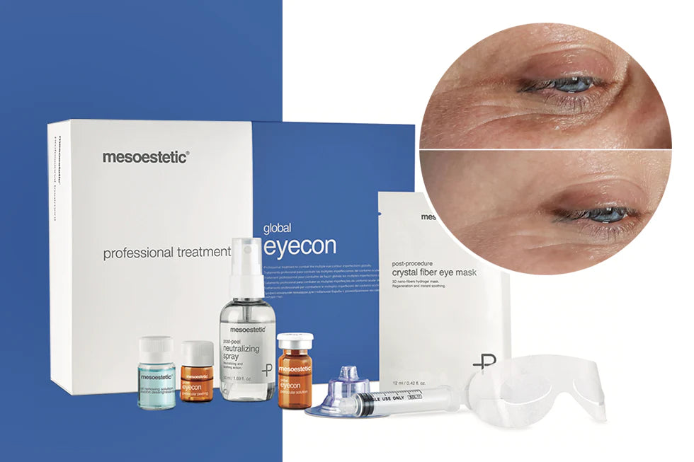 Eyecon Treatment Mesoestetic (6 Tratamientos)