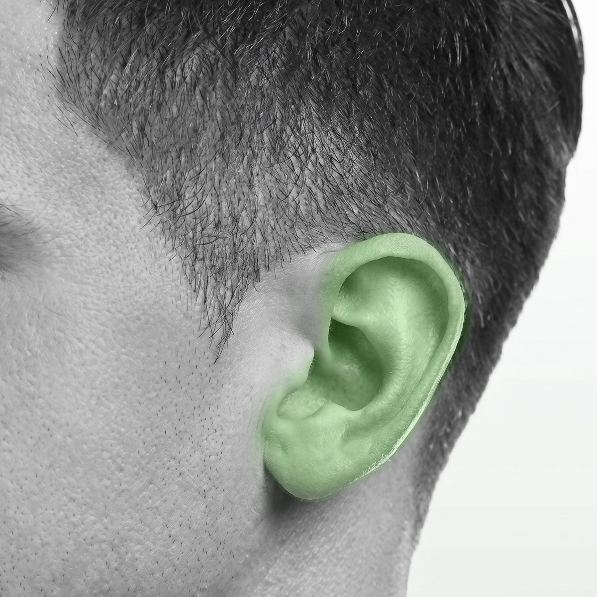 Láser Cuello y Orejas 5 Seciones