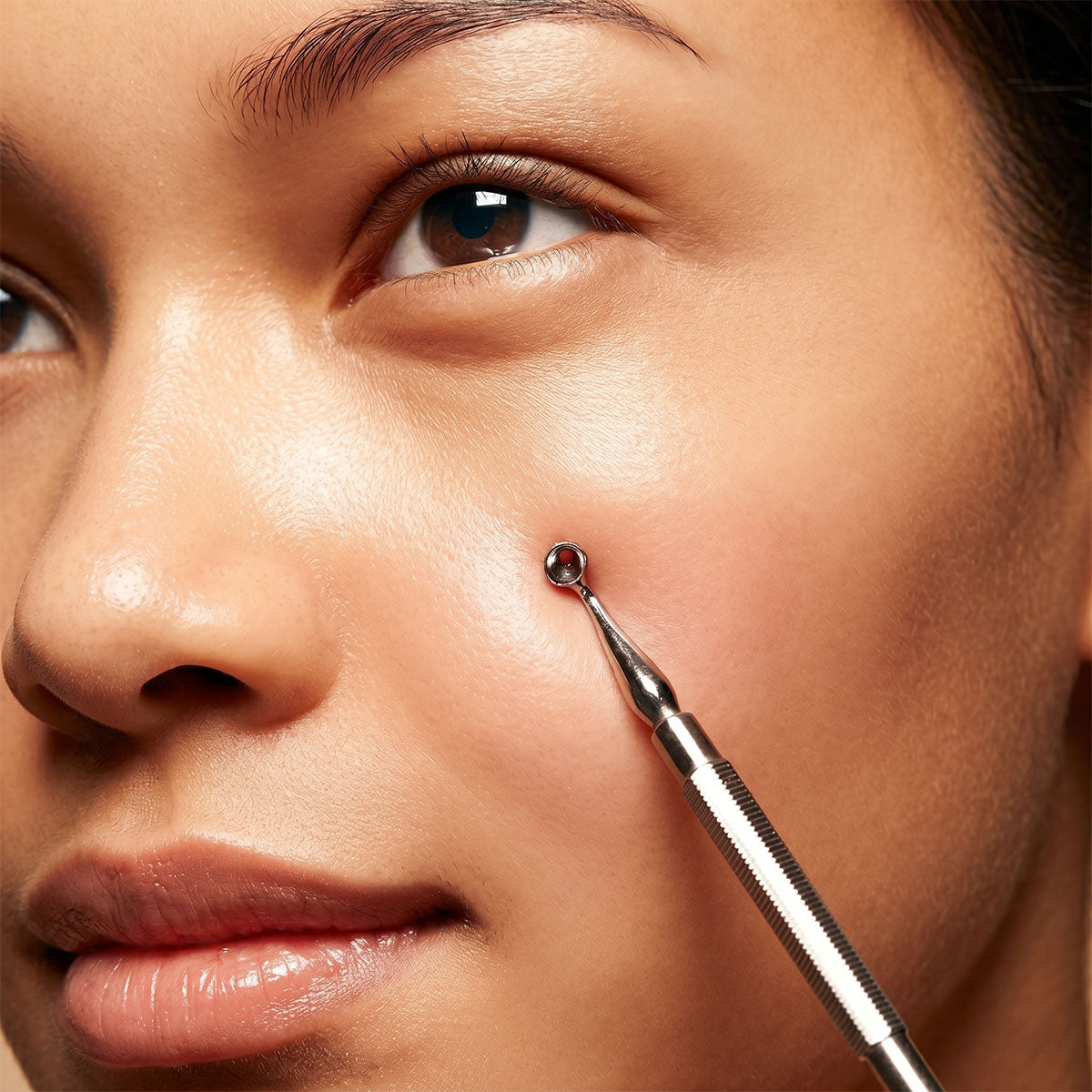 Extracción Facial