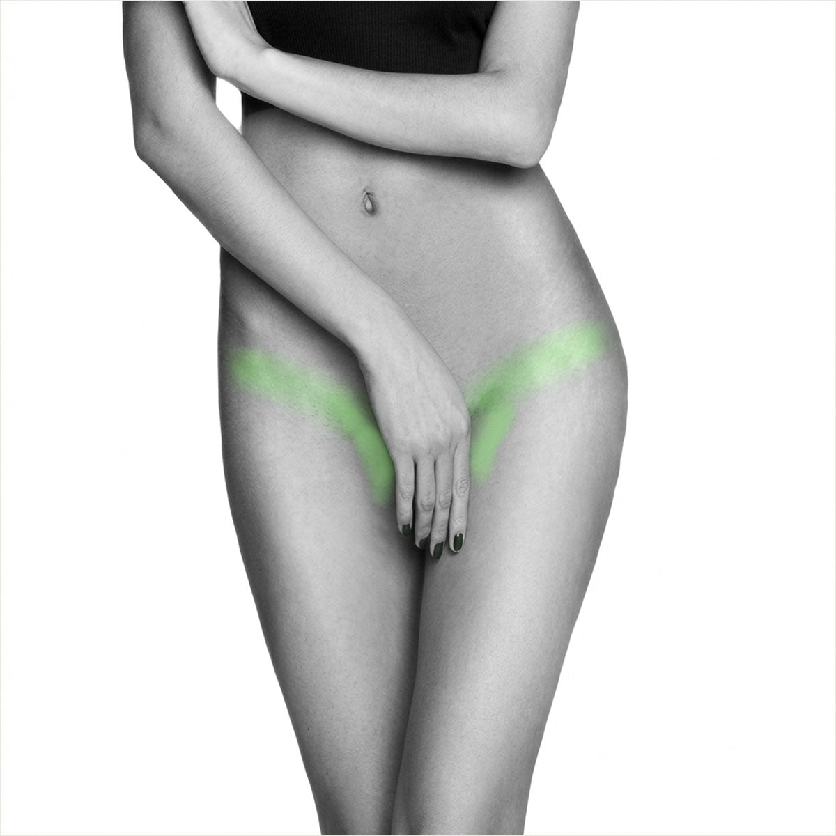 Depilación Láser Bikini Line