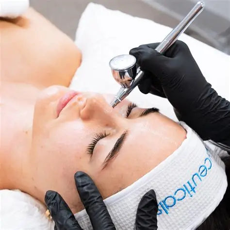 Oxígeno Facial (incluye microdermabracion o peeling y LED) 2 Tratamientos