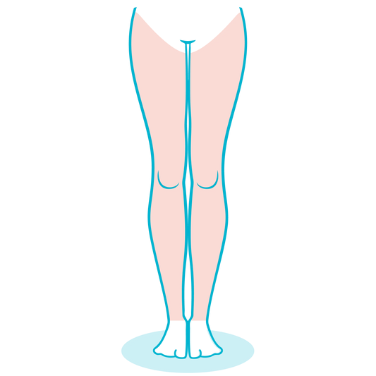 Laser Piernas Completas 5 Sesiones