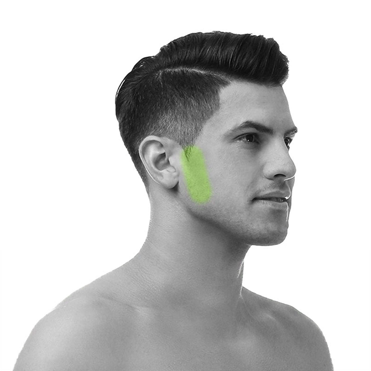 Depilación Láser Patillas