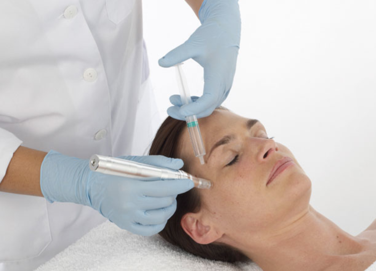 Microagujas (Despigmentacion, Fotorejuvenecimiento, Infucion de Peptidos , Firmeza)