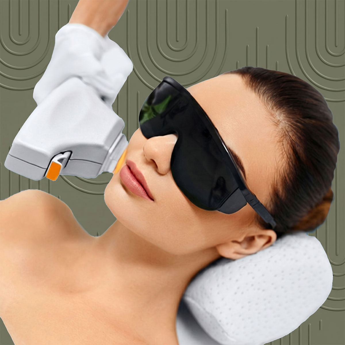 IPL Fotofacial
