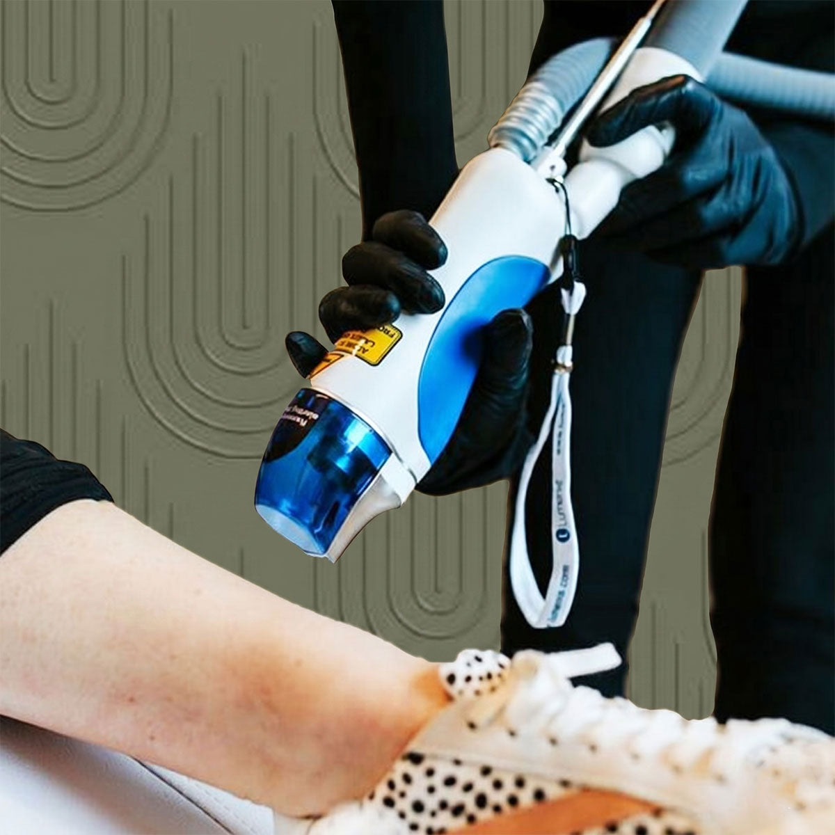 Spider Veins Treatment