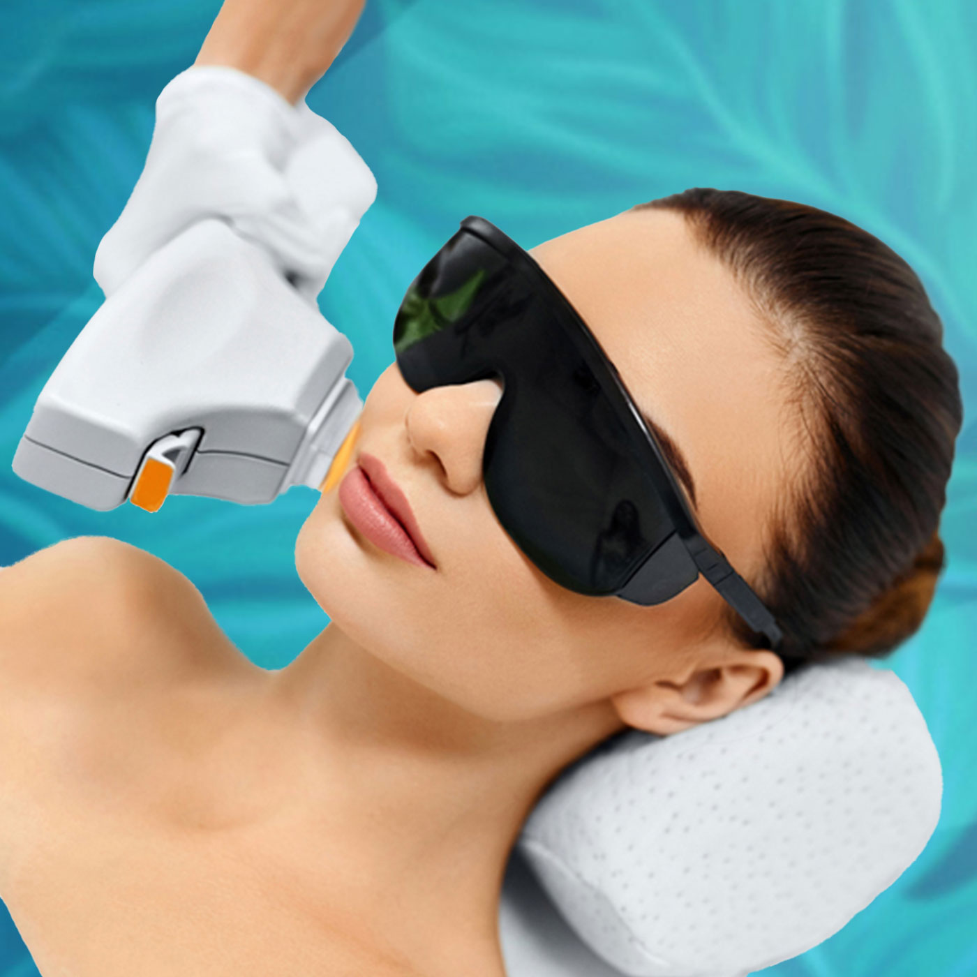 IPL Fotofacial